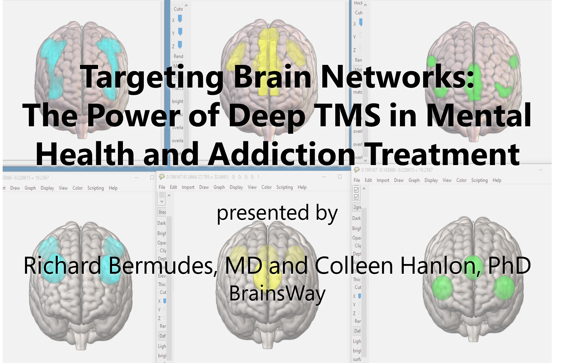 Targeting Brain Networks: The Power of Deep TMS in Mental Health and Addiction Treatment