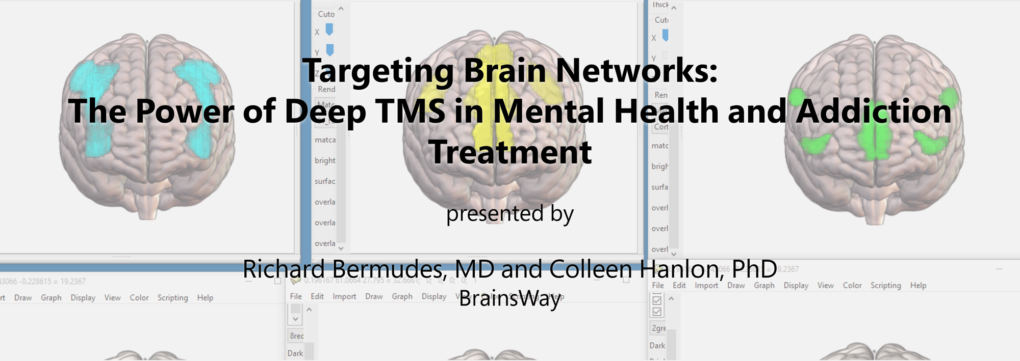 Targeting Brain Networks: The Power of Deep TMS in Mental Health and Addiction Treatment